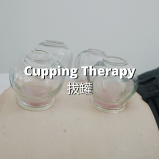 Beacon TCM: Cupping Therapy
