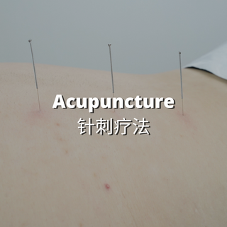 Beacon TCM: Acupuncture