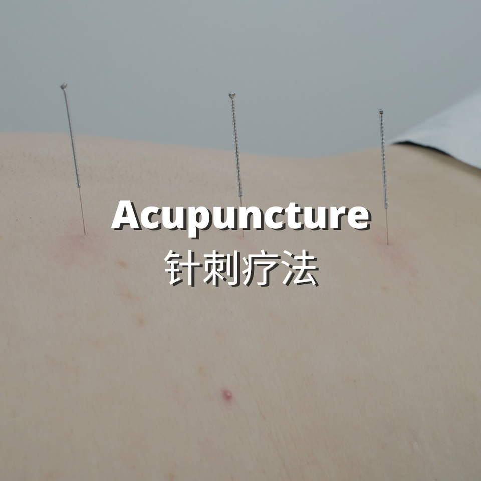 Beacon TCM: Acupuncture